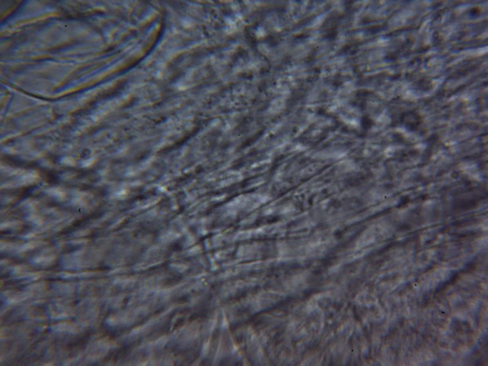 Microscopía de Pluteus aurantiorugosus - 10 - Subpellis agua